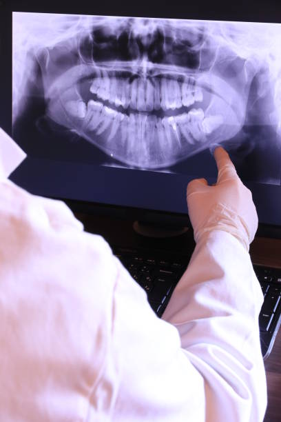 Best Emergency Dental Care for Broken or Chipped Teeth in Leola, PA
